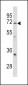 GARP Antibody (Center)