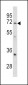 GARP Antibody (Center)