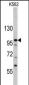 MTBP Antibody (C-term)