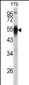 PDIA6 Antibody (Center K159)