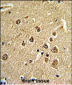 PID/MTA2 Antibody (C-term)