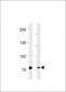 PID/MTA2 Antibody (C-term)
