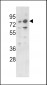 PLZF Antibody (C-term)