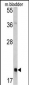 RAB13 Antibody (Center)