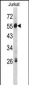 SERPING1 Antibody (Center)