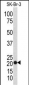 TAGLN Antibody (N-term)