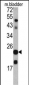 TAGLN Antibody (C-term)