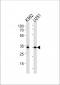 TBP Antibody (Center)