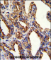 TROP2 Antibody (Center)
