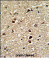 XPO1 Antibody (C-term)