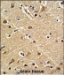 ZWINT Antibody (Center)