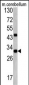 ZWINT Antibody (Center)