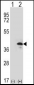 ZWINT Antibody (Center)