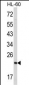 RAN Antibody (N-term)