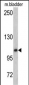 OGT Antibody (C-term)