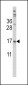 TTR Antibody (Center)