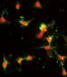 CCL2 Antibody (C-term)