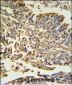 HSP27 Antibody (Center)