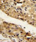 SERPINF1 Antibody (N-term)