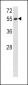 SERPINF1 Antibody (N-term)