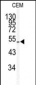 KLF5 Antibody (Center)