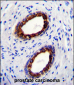 CYK18 Antibody (C-term)