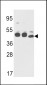 CYK18 Antibody (C-term)