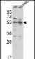 TMPRSS2 Antibody (N-term)