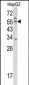 TMPRSS2 Antibody (Center)