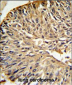 DHFR Antibody (C-term)