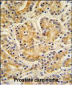 MOBKL1B Antibody (C-term)