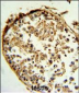 CTSS Antibody (Center)