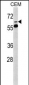 FKBP10 Antibody (N-term)