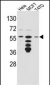 FKBP4 Antibody (Center)