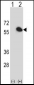 FKBP4 Antibody (Center)