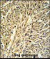 IMPDH2 Antibody (Center)