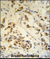 RBM3 Antibody (Center)