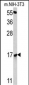 RBM3 Antibody (Center)