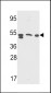 SAP Antibody (Center E300)