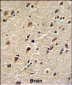 DDX5 Antibody (Center)