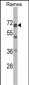 DDX5 Antibody (Center)