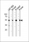 GPT Antibody (N-term R133)