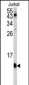 FKBP1A Antibody (C-term)