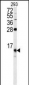 FKBP1B Antibody (N-term)