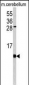 FKBP1B Antibody (N-term)