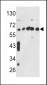 CCT3 Antibody (Center)