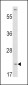 VHL Antibody (N-term)