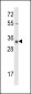 Calponin-3 Antibody (N-term)