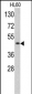 TBP Antibody (C-term)