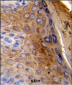 KRT10 Antibody (Center)